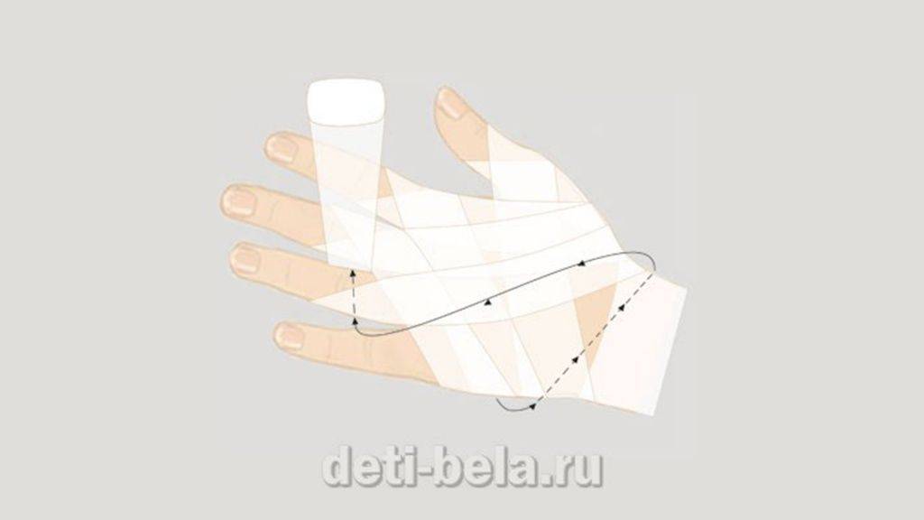 Бинтование-суставы-9.jpg