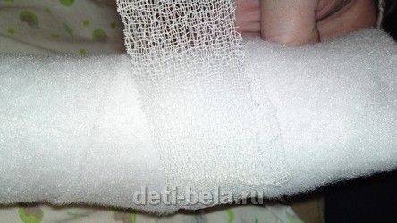 Перевязка ног 3.jpg