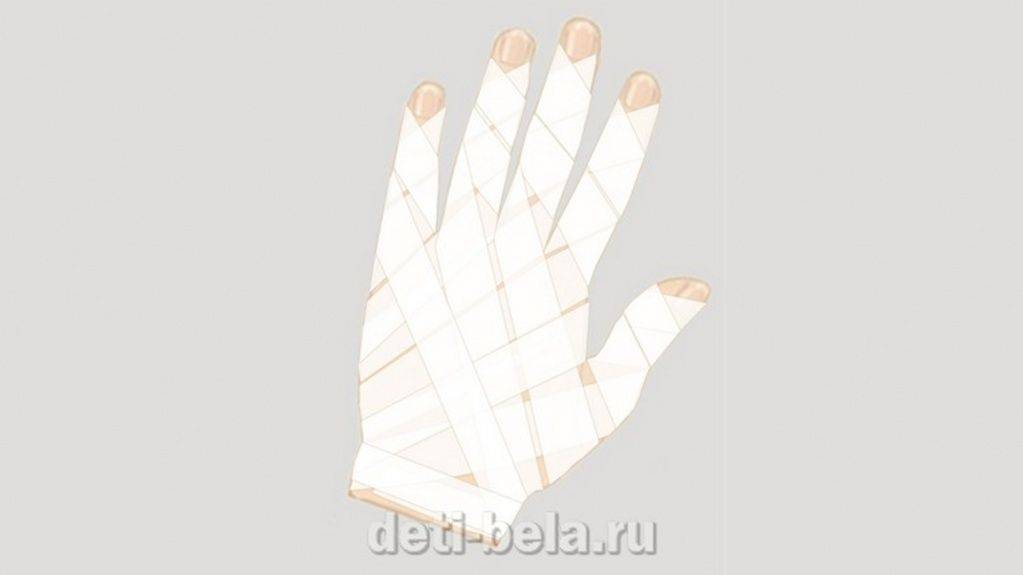 Бинтование10.jpg